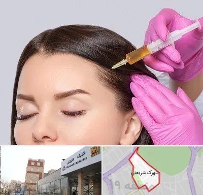 تزریق هیر فیلر در شهرک شریعتی