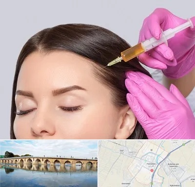 تزریق هیر فیلر در فلاورجان