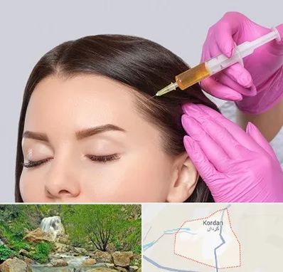 تزریق هیر فیلر در کردان