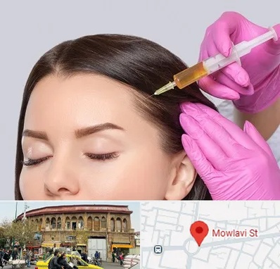 تزریق هیر فیلر در مولوی