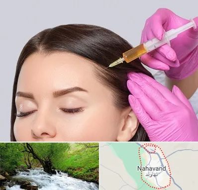 تزریق هیر فیلر در نهاوند