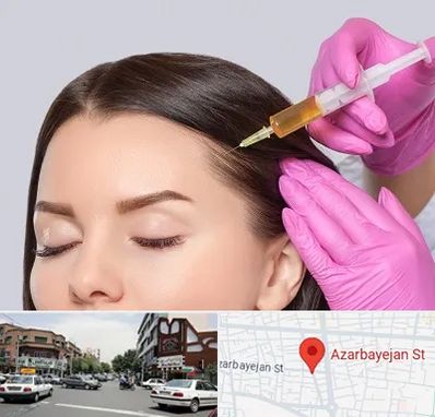 تزریق هیر فیلر در خیابان آذربایجان