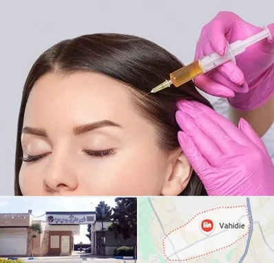 تزریق هیر فیلر در وحیدیه شهریار