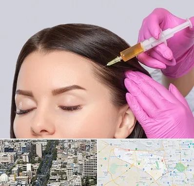 تزریق هیر فیلر در منطقه 18 تهران 