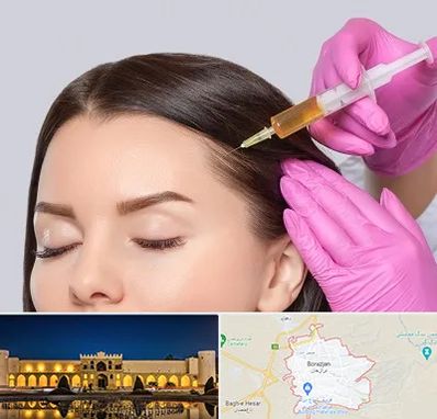 تزریق هیر فیلر در برازجان