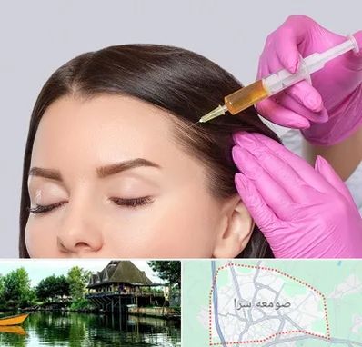 تزریق هیر فیلر در صومعه سرا