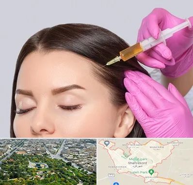 تزریق هیر فیلر در شهرکرد