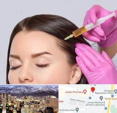 تزریق هیر فیلر در جردن 