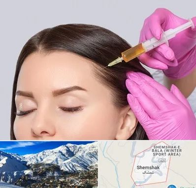 تزریق هیر فیلر در شمشک