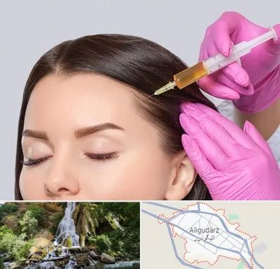 تزریق هیر فیلر در الیگودرز