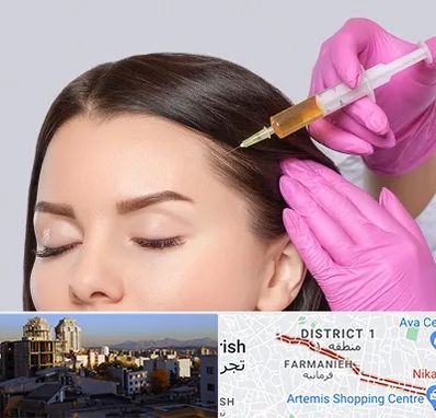 تزریق هیر فیلر در فرمانیه 