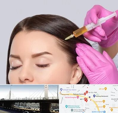 تزریق هیر فیلر در پارک وی 