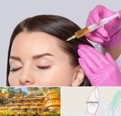 تزریق هیر فیلر در دربند