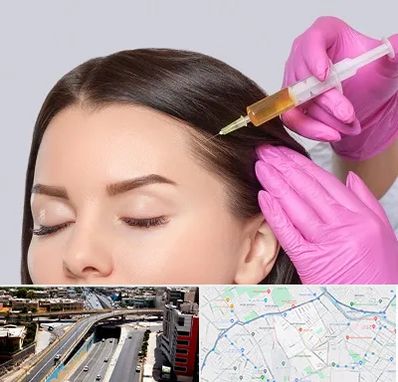 تزریق هیر فیلر در ستارخان شیراز