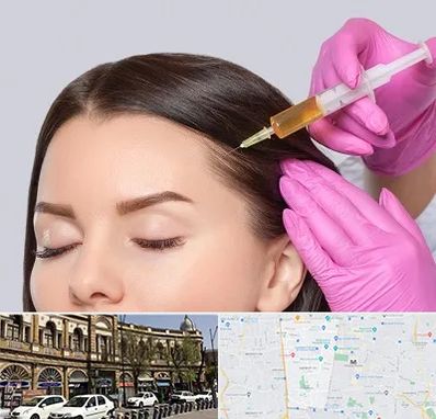 تزریق هیر فیلر در منطقه 11 تهران 