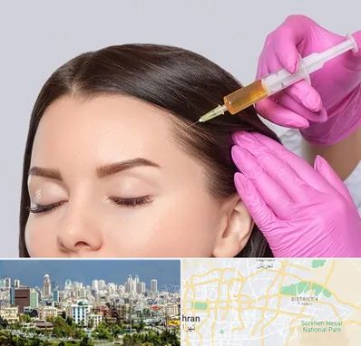 تزریق هیر فیلر در شرق تهران 