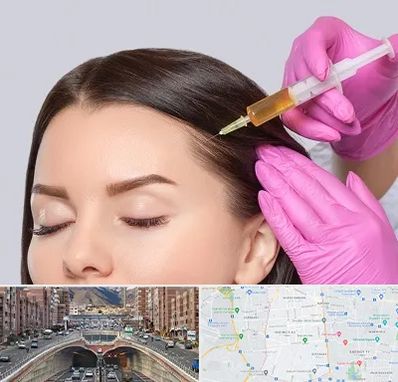 تزریق هیر فیلر در منطقه 10 تهران 