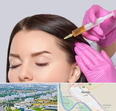 تزریق هیر فیلر در آبادان