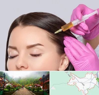 تزریق هیر فیلر در فومن