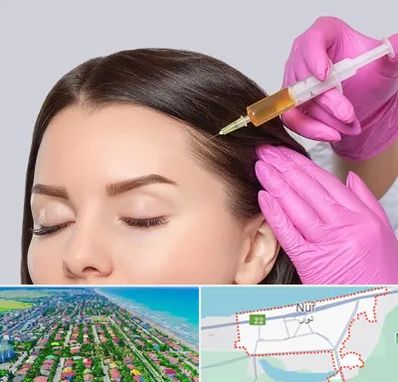 تزریق هیر فیلر در نور