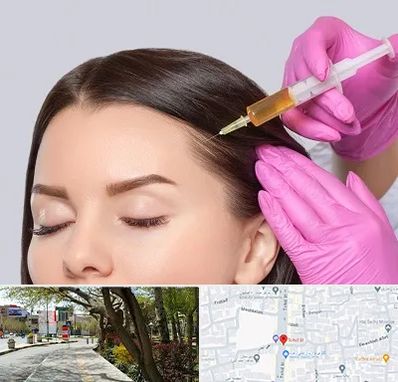 تزریق هیر فیلر در خیابان توحید اصفهان