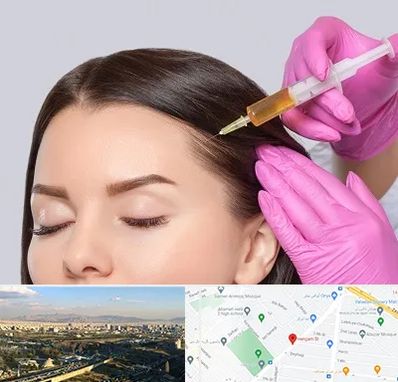 تزریق هیر فیلر در هنگام 