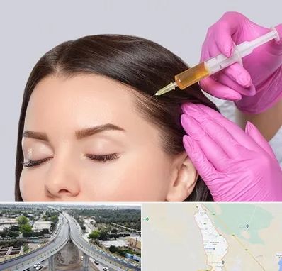 تزریق هیر فیلر در اندیمشک