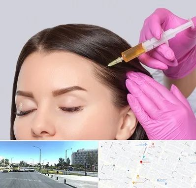 تزریق هیر فیلر در بلوار کلاهدوز مشهد