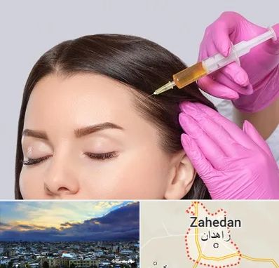 تزریق هیر فیلر در زاهدان