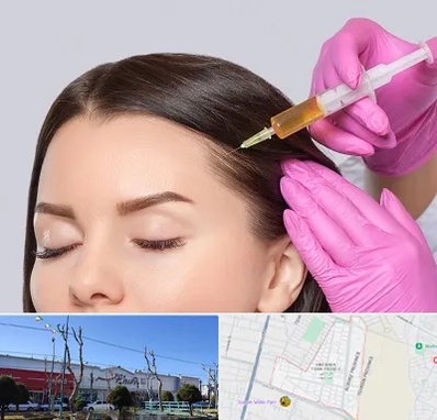 تزریق هیر فیلر در فاز دو اندیشه