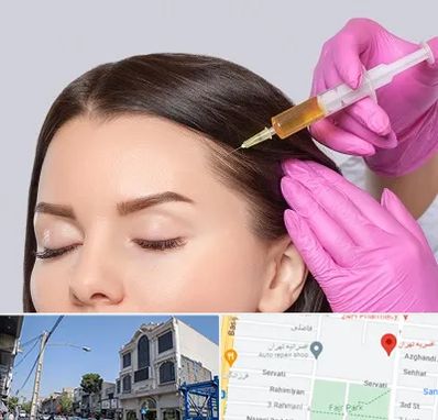 تزریق هیر فیلر در افسریه 