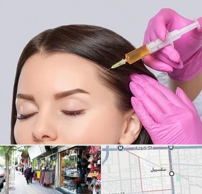 تزریق هیر فیلر در سلسبیل