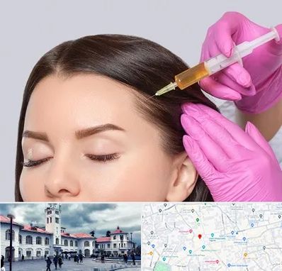 تزریق هیر فیلر در میدان شهرداری رشت