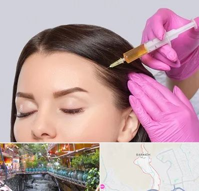 تزریق هیر فیلر در درکه