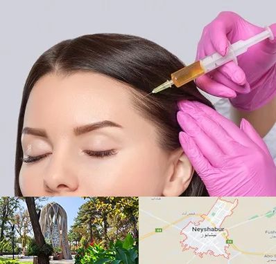 تزریق هیر فیلر در نیشابور