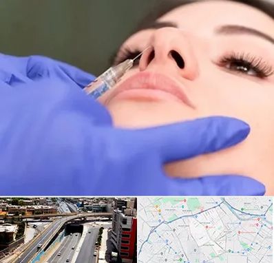 هیالاز در ستارخان شیراز