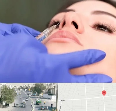 هیالاز در هاشمی