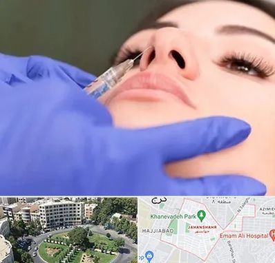 هیالاز در جهانشهر کرج 