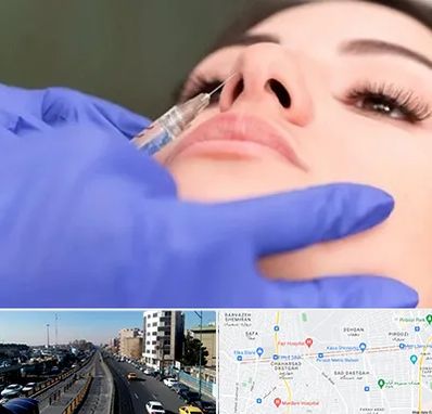 هیالاز در پیروزی 