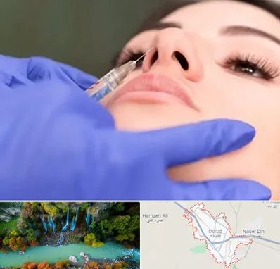 هیالاز در دورود