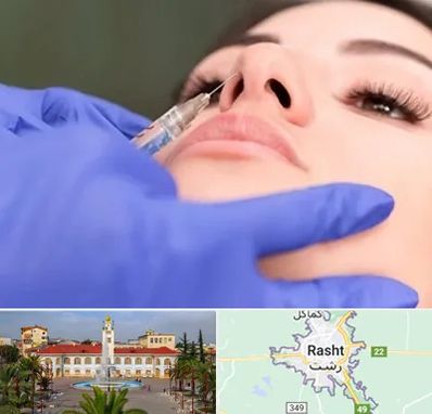 هیالاز در رشت