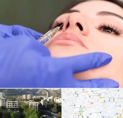 هیالاز در دیباجی 