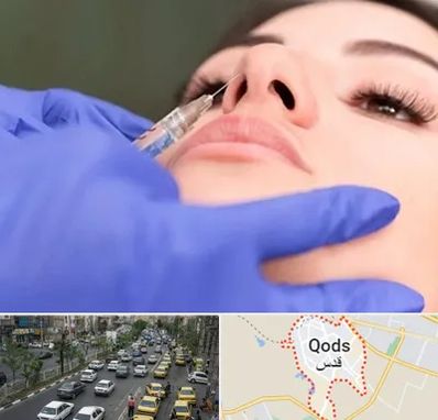 هیالاز در شهر قدس