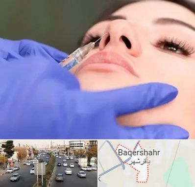 هیالاز در باقرشهر