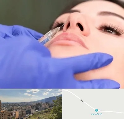 هیالاز در بوکان تهران