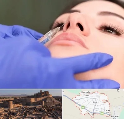 هیالاز در بم