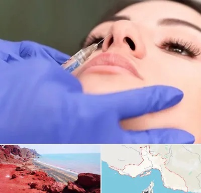 هیالاز در هرمزگان
