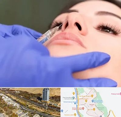 هیالاز در خیابان نیایش شیراز