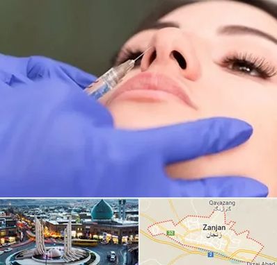 هیالاز در زنجان