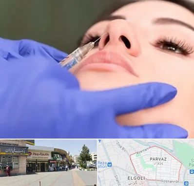 هیالاز در پرواز تبریز